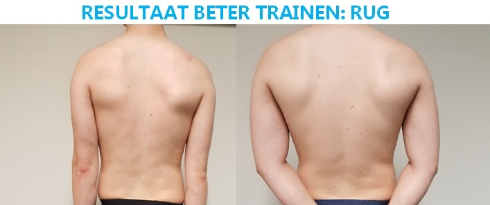 Resultaat rug